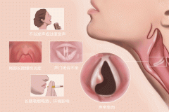 重庆耳鼻喉医院，声带息肉的常见症状
