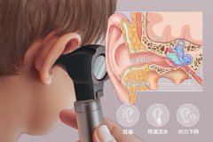 中耳炎是怎么引起的，重庆耳鼻喉