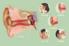 重庆外耳道炎医院,外耳道炎的症状有哪些