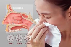 重庆鼻炎专科医院排名，鼻炎的症状及治疗方法