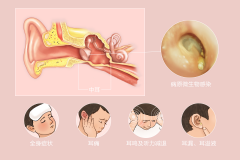 宝宝中耳炎应该怎样预防？